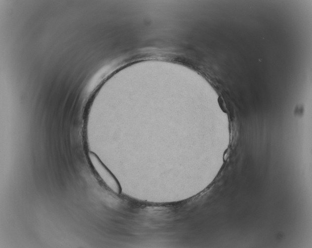 X0000111520150200908251146