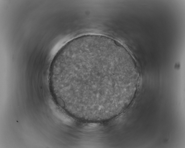 X0000111520151200908251146