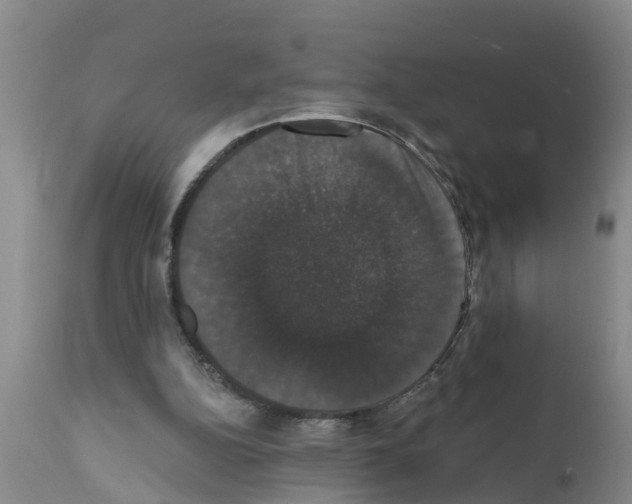 X0000111520152200908251146
