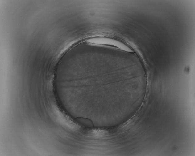 X0000111520154200908251146