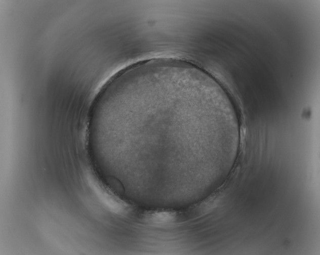 X0000111520156200908251146