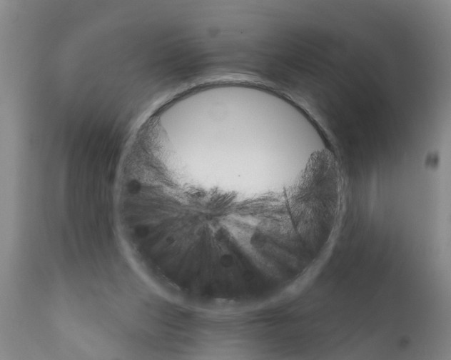 X0000111520159200908251146