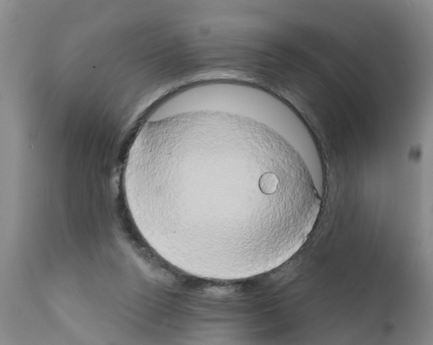 X0000111520160200908251146