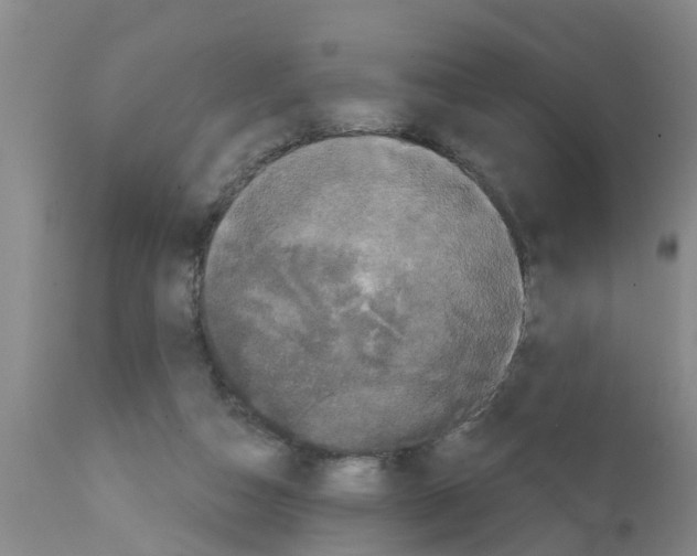X0000111520162200908251146