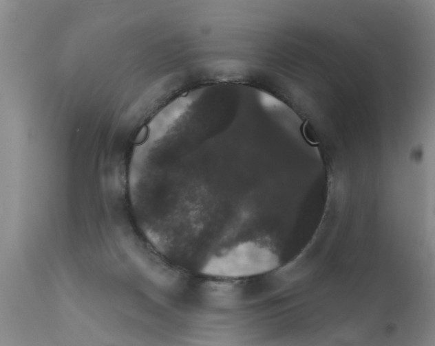 X0000111520170200908251146
