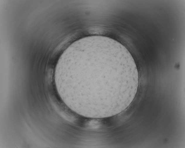 X0000111520171200908251146