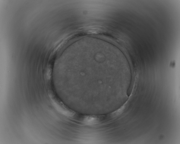 X0000111520174200908251146