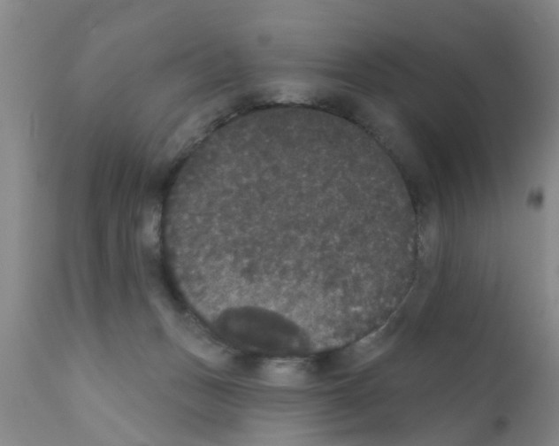 X0000111520175200908251146