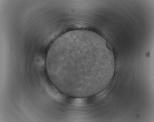 X0000111520176200908251146
