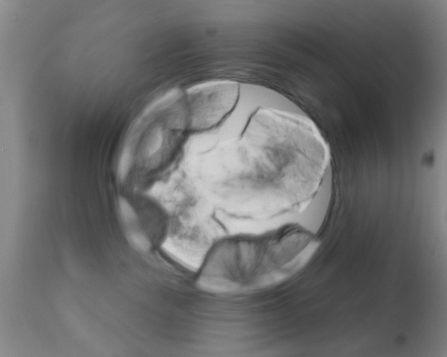 X0000111520189200908251146