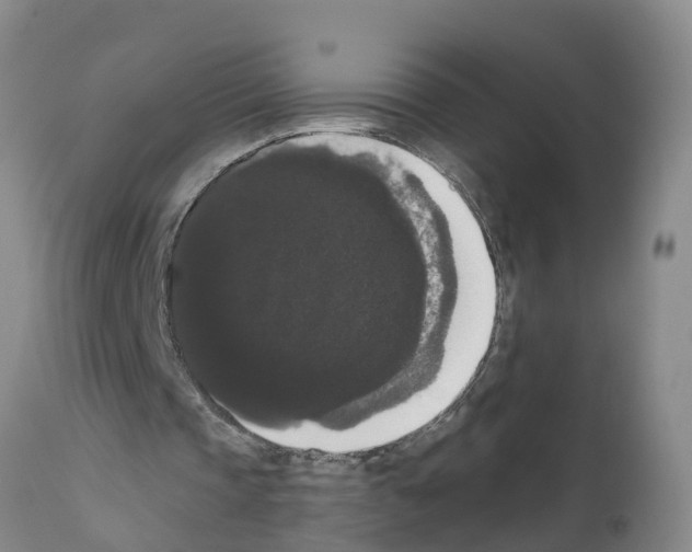 X0000111520337200908251142