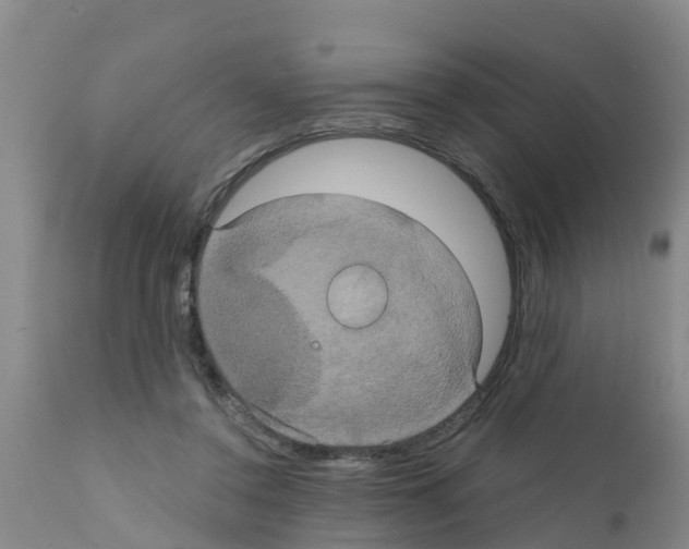 X0000111520356200908251143