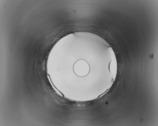 X0000111520368200908251143