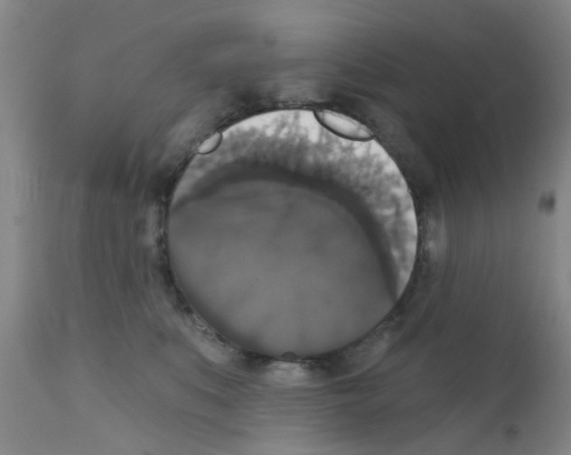 X0000111520519200908251140