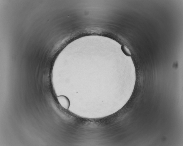 X0000111520538200908251139