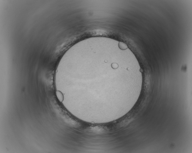 X0000111520545200908251140