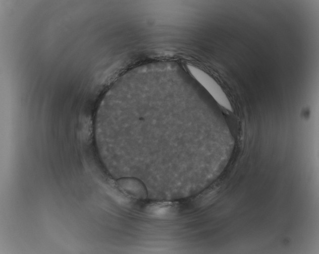 X0000111520563200908251140