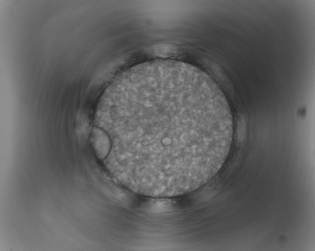 X0000111520569200908251140