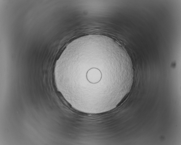 X0000111520570200908251140