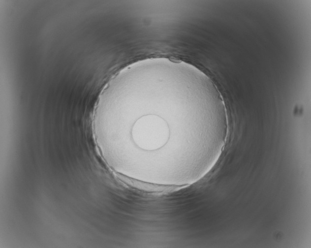 X0000111520576200908251140
