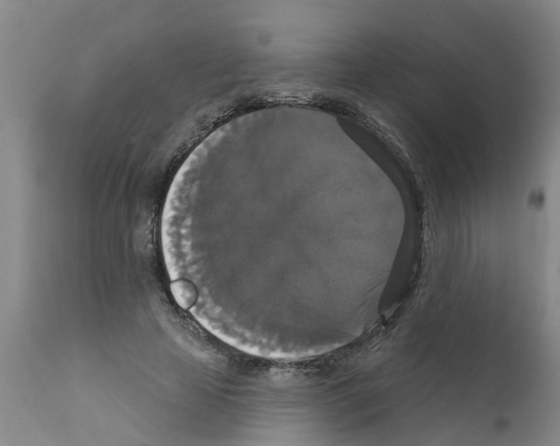 X0000111520641200908251138