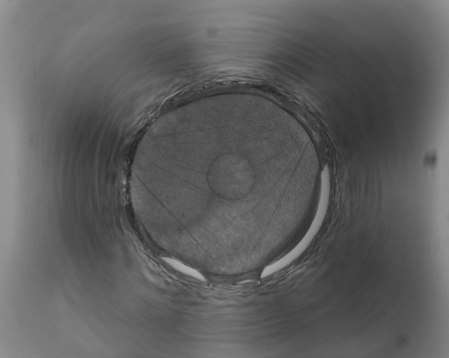 X0000111520868200908251135