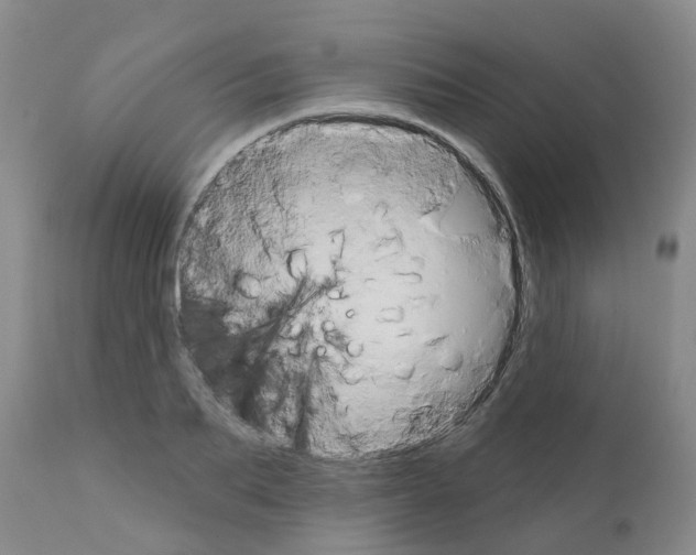 X0000111520887200908251134