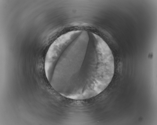 X0000111520966200908251133