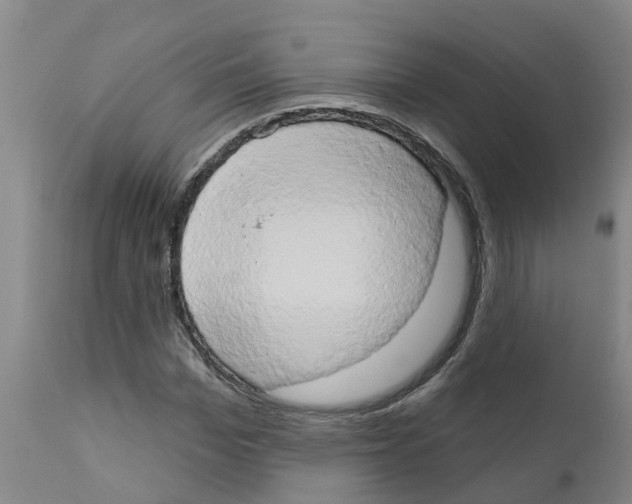 X0000111520969200908251133
