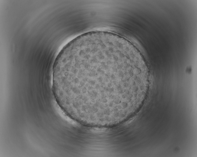 X0000111521036200908251132