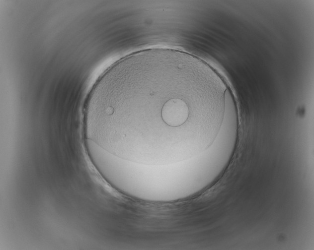 X0000111521096200908251131