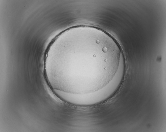 X0000111521128200908251130