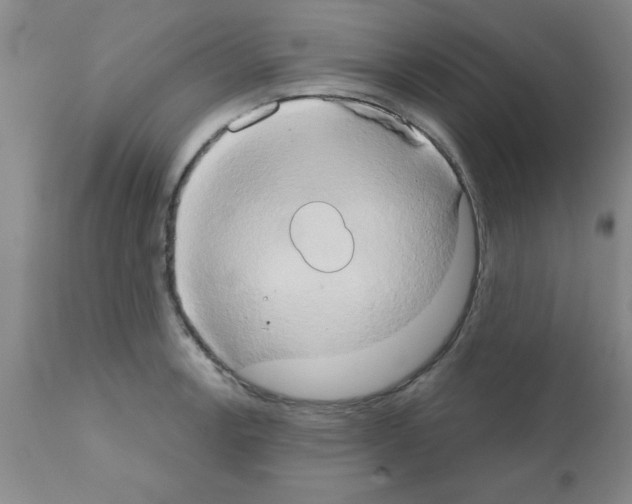 X0000111521138200908251130