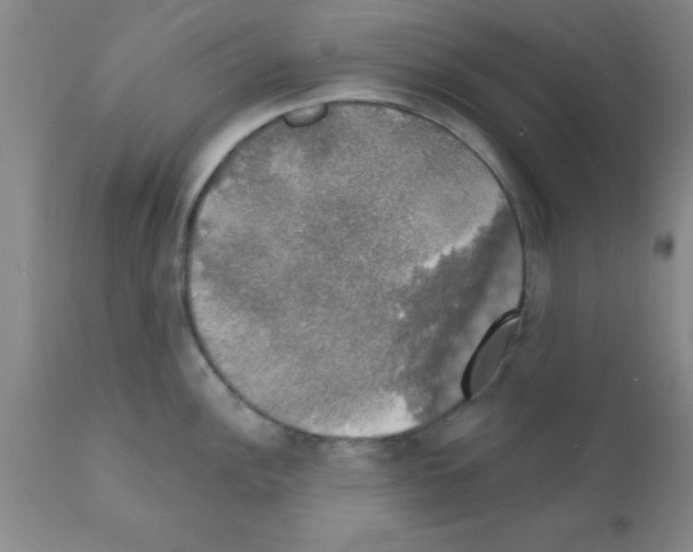 X0000111521148200908251131