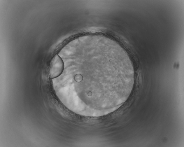 X0000111521158200908251130