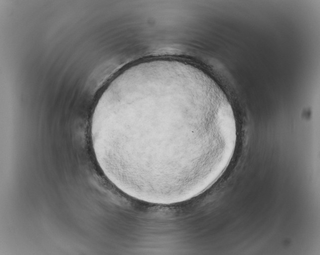 X0000111521217200908251128