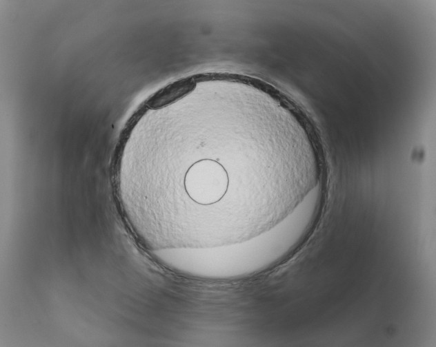 X0000111521264200908251128