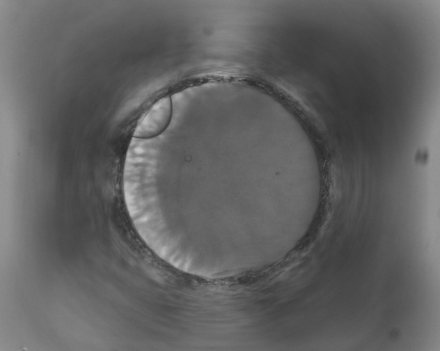 X0000111521399200908251125