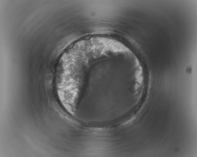X0000111521401200908251125