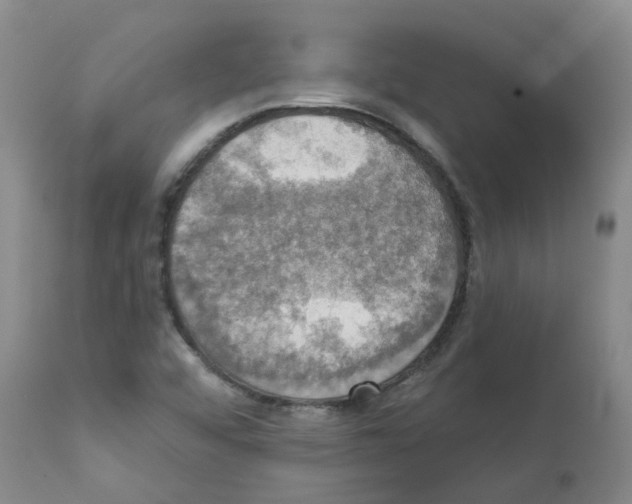 X0000111521456200908251125