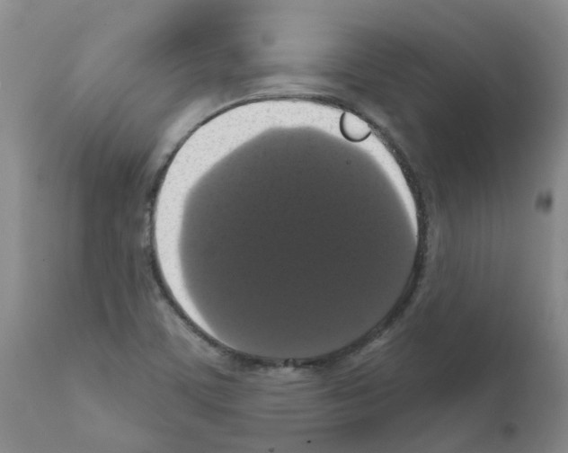 X0000111521459200908251125