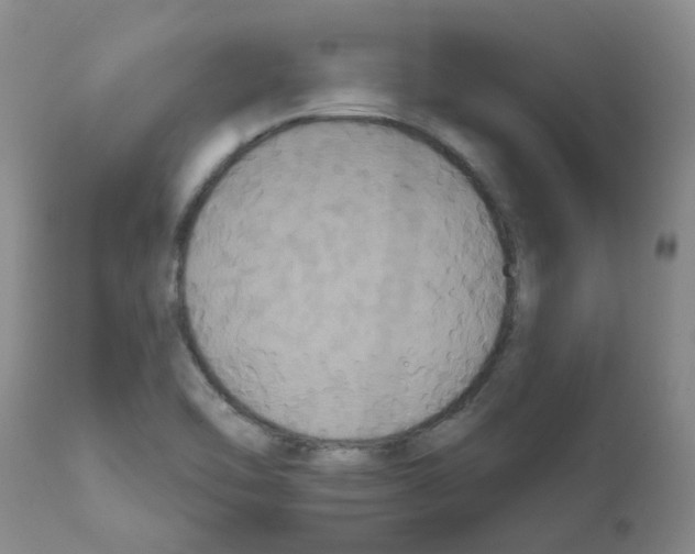 X0000111521462200908251125