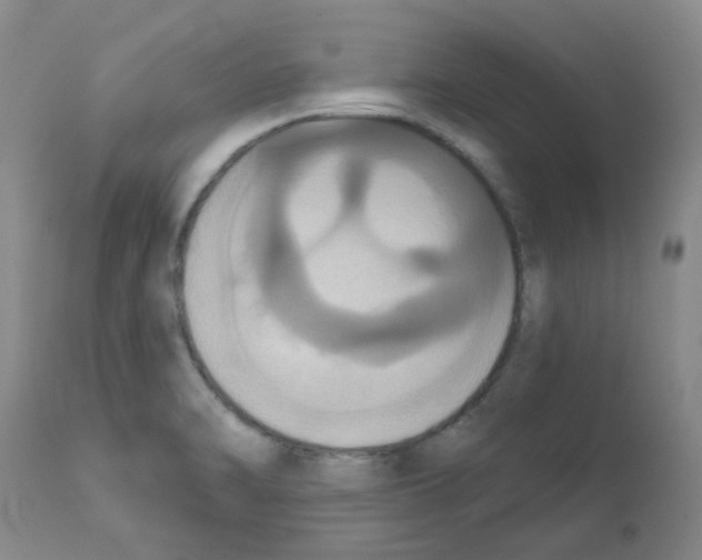 X0000111521470200908251125