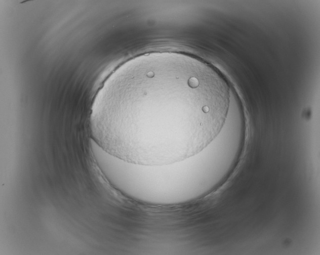 X0000111521481200908251125
