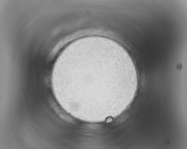 X0000111521499200908251124