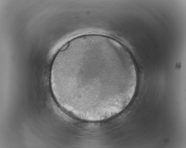 X0000111521504200908251124