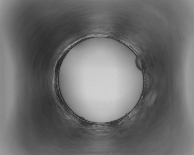 X0000111530338200907141301