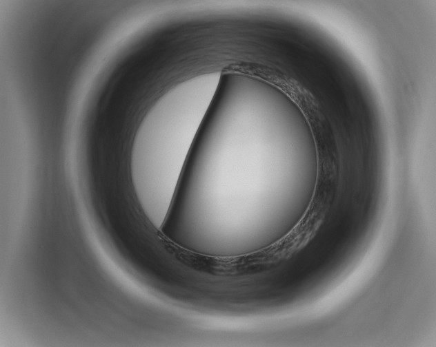 X0000111530766200907141256