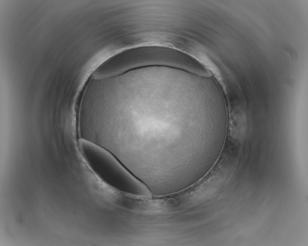 X0000111531096200907141523