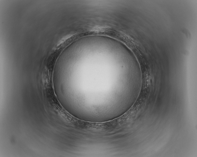 X0000111531158200907141522